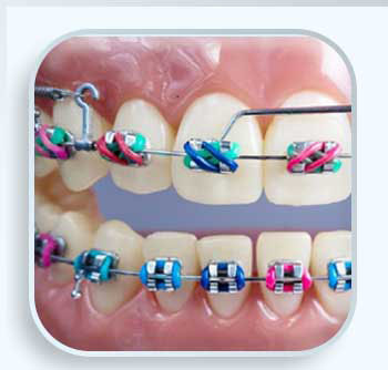 ارتودنسی  دندان